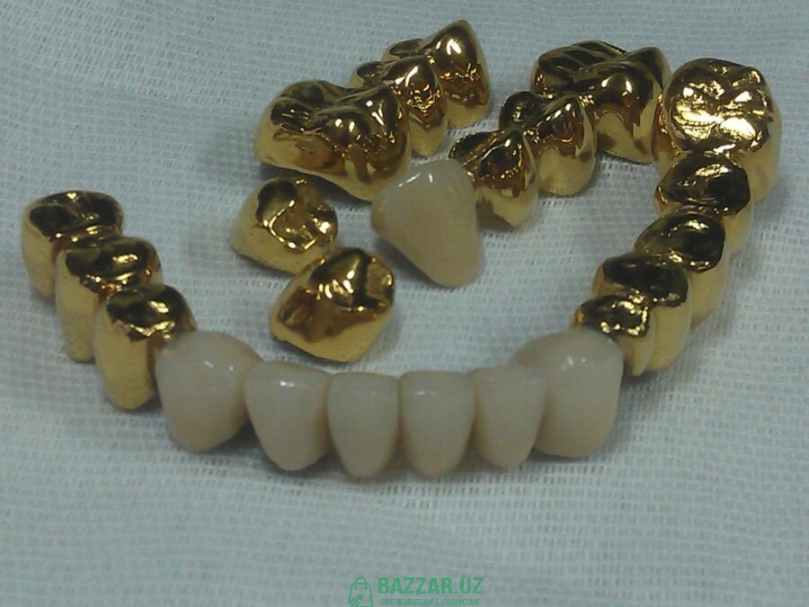 Установки покрытия зубных протезов «под золото»